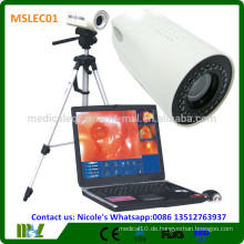 MSLEC01i New Tech Medizinische digitale Kolposkope / Vagina Video Colposcope